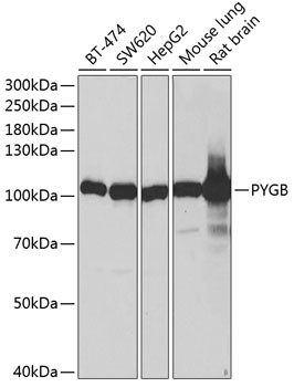 PYGB Antibody