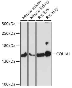 COL1A1 Antibody