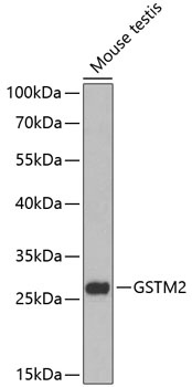 GSTM2 Antibody