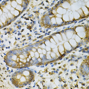 GSTM2 Antibody