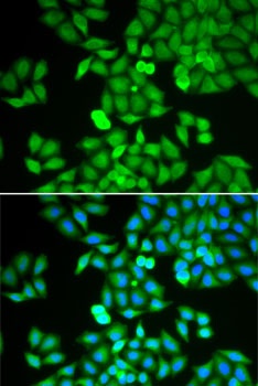 ARHGDIA Antibody