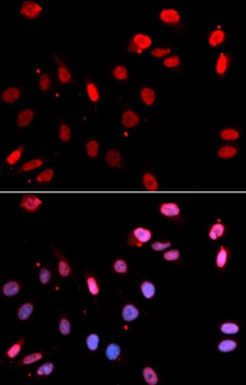 RAD18 Antibody