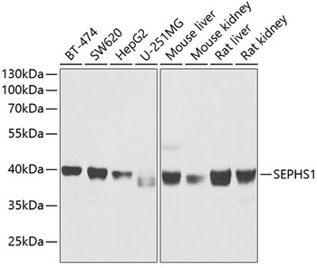 SEPHS1 Antibody