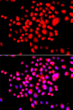 STK19 Antibody