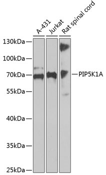 PIP5K1A Antibody