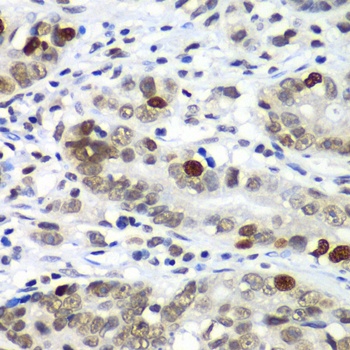 DR1 Antibody