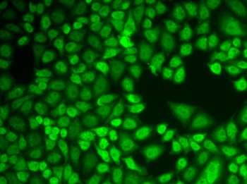 CTSD Antibody