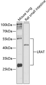 LRAT Antibody