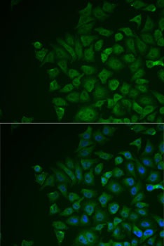 LRAT Antibody