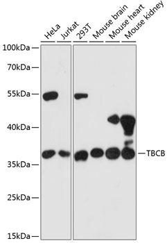 TBCB Antibody