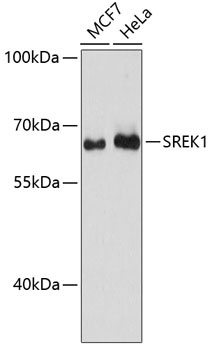SREK1 Antibody