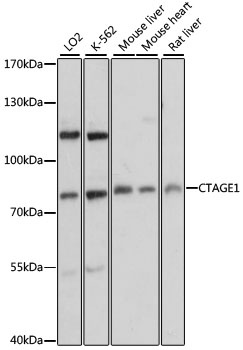 CTAGE1 Antibody
