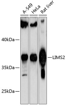 LIMS2 Antibody