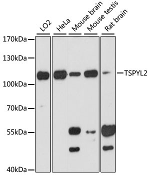 TSPYL2 Antibody