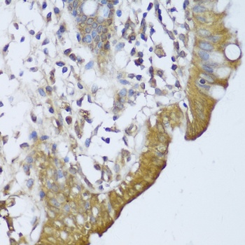GCN1L1 Antibody