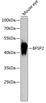 BFSP2 Antibody