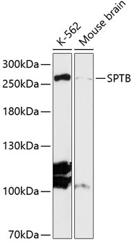SPTB Antibody