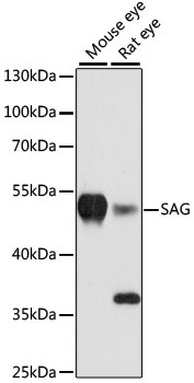 SAG Antibody