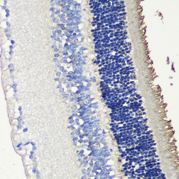 SAG Antibody