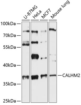 CALHM2 Antibody