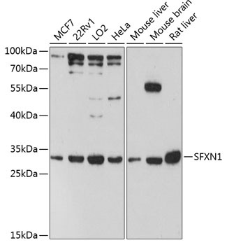 SFXN1 Antibody
