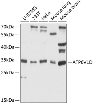 ATP6V1D Antibody