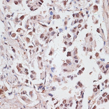 DKC1 Antibody