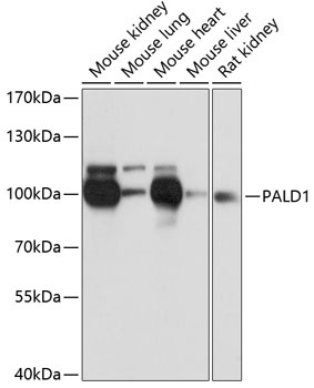 PALD1 Antibody