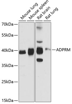 ADPRM Antibody