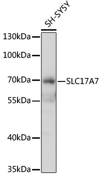 SLC17A7 Antibody
