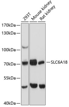 SLC6A18 Antibody