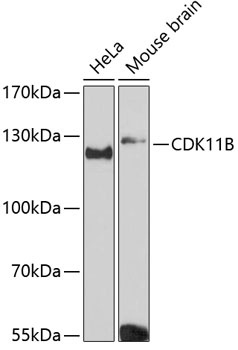 CDK11B Antibody