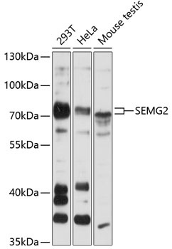 SEMG2 Antibody