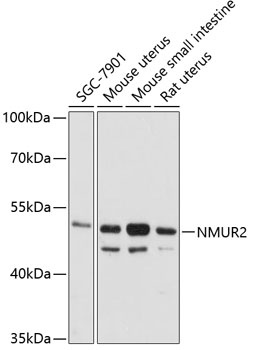 NMUR2 Antibody