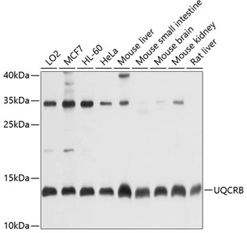 UQCRB Antibody