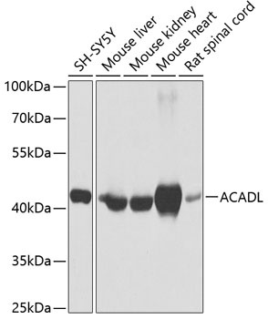 ACADL Antibody