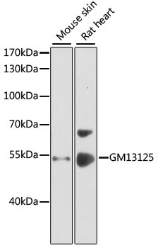 GM13125 Antibody