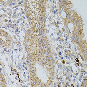 OCLN Antibody