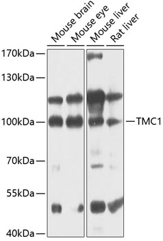 TMC1 Antibody