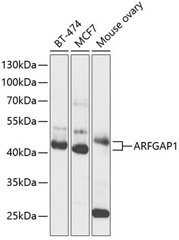 ARFGAP1 Antibody