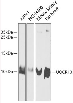 UQCR10 Antibody