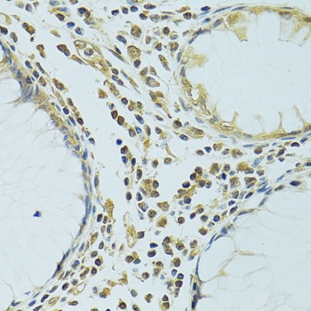 METTL13 Antibody
