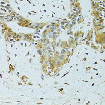 METTL13 Antibody