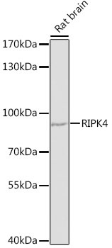 RIPK4 Antibody