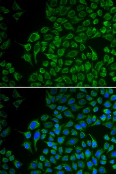 TYR Antibody