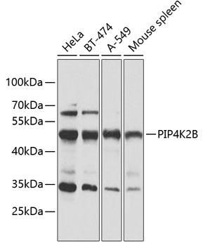 PIP4K2B Antibody