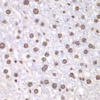 TOP1 Antibody