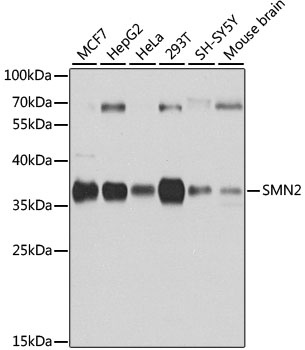 SMN2 Antibody