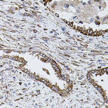 SHH Antibody