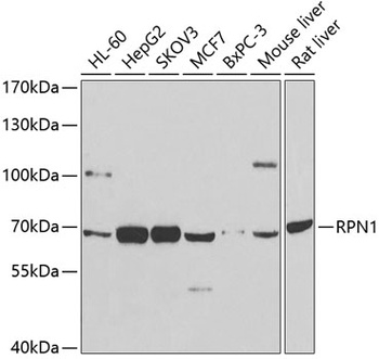 RPN1 Antibody